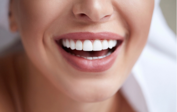 A close up of a woman with a perfectly straight, white smile
