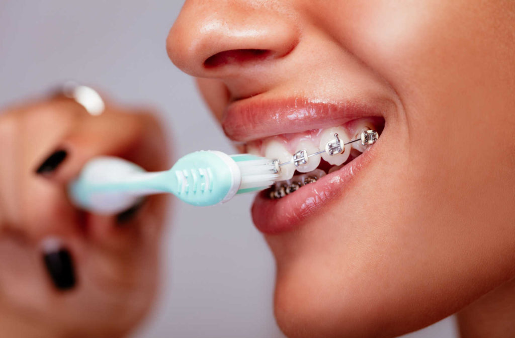 A close up of a person brushing their teeth with braces to maintain good oral health.