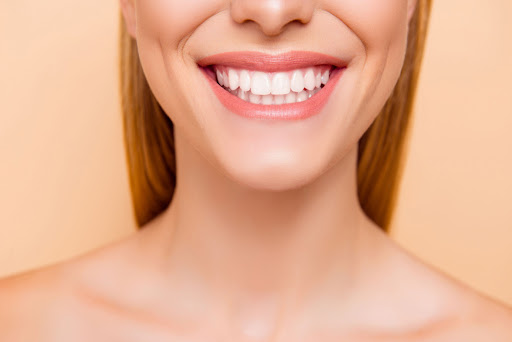 A woman smiling with veneers, showing her perfect white smile.