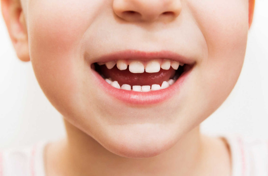 A close up of a young child's smile, showing their teeth and how proper hygiene can maintain good oral health.