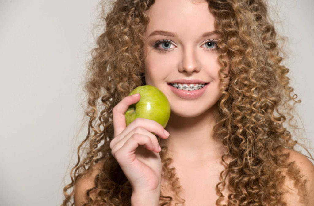 A woman with braces holding an apple, an example of a food that can be difficult to directly bite into with braces