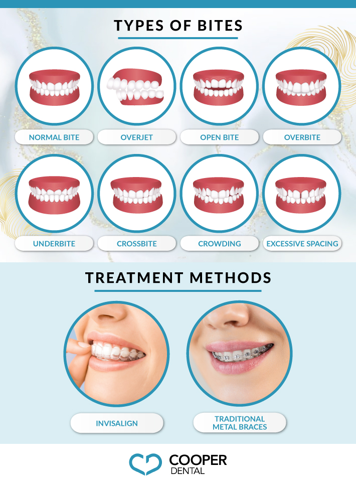 An infographic showing the types of bites like overjet, overbite, underbite and the treatment options like invisalign and braces.