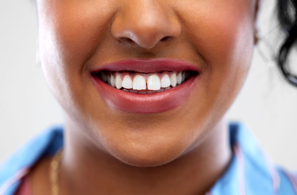 A close up of a smile with gaps between the teeth that can be fixed by dental bonding.