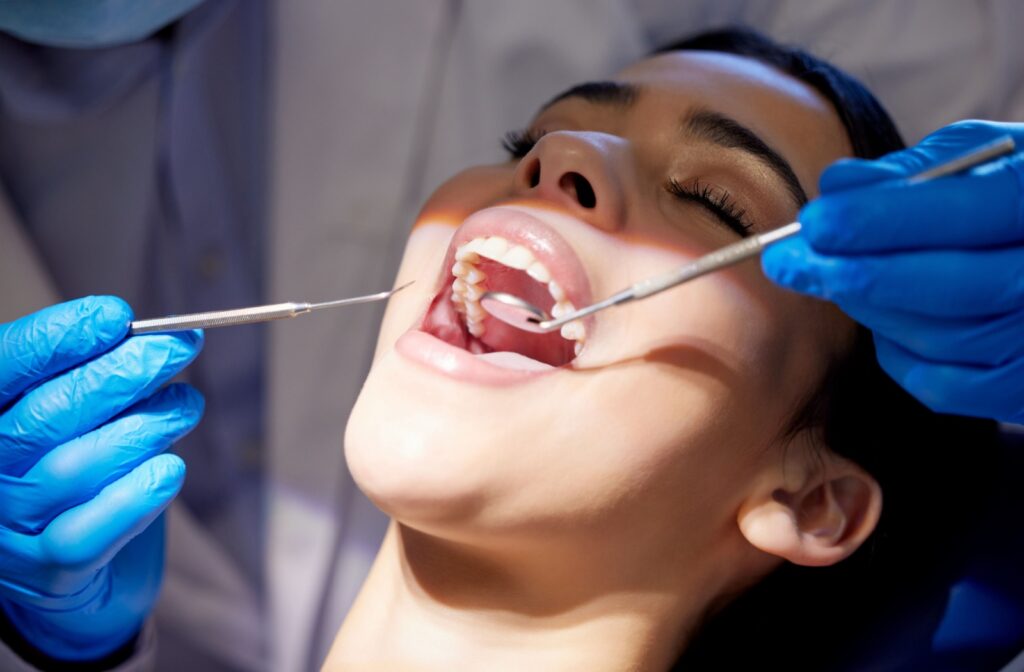 A dental patient with their mouth open during a routine exam and cleaning having their dentist check for signs of cavities.